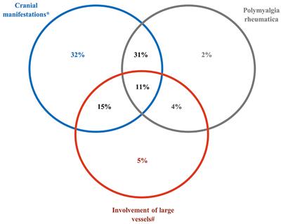 Presentation and Real-World Management of Giant Cell Arteritis (Artemis Study)